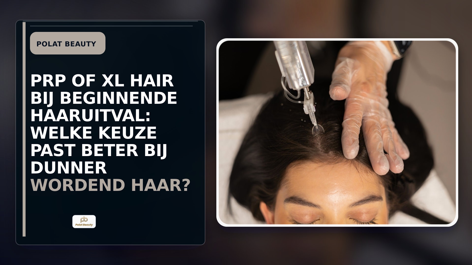 PRP of XL Hair bij beginnende haaruitval: welke keuze past beter bij dunner wordend haar?