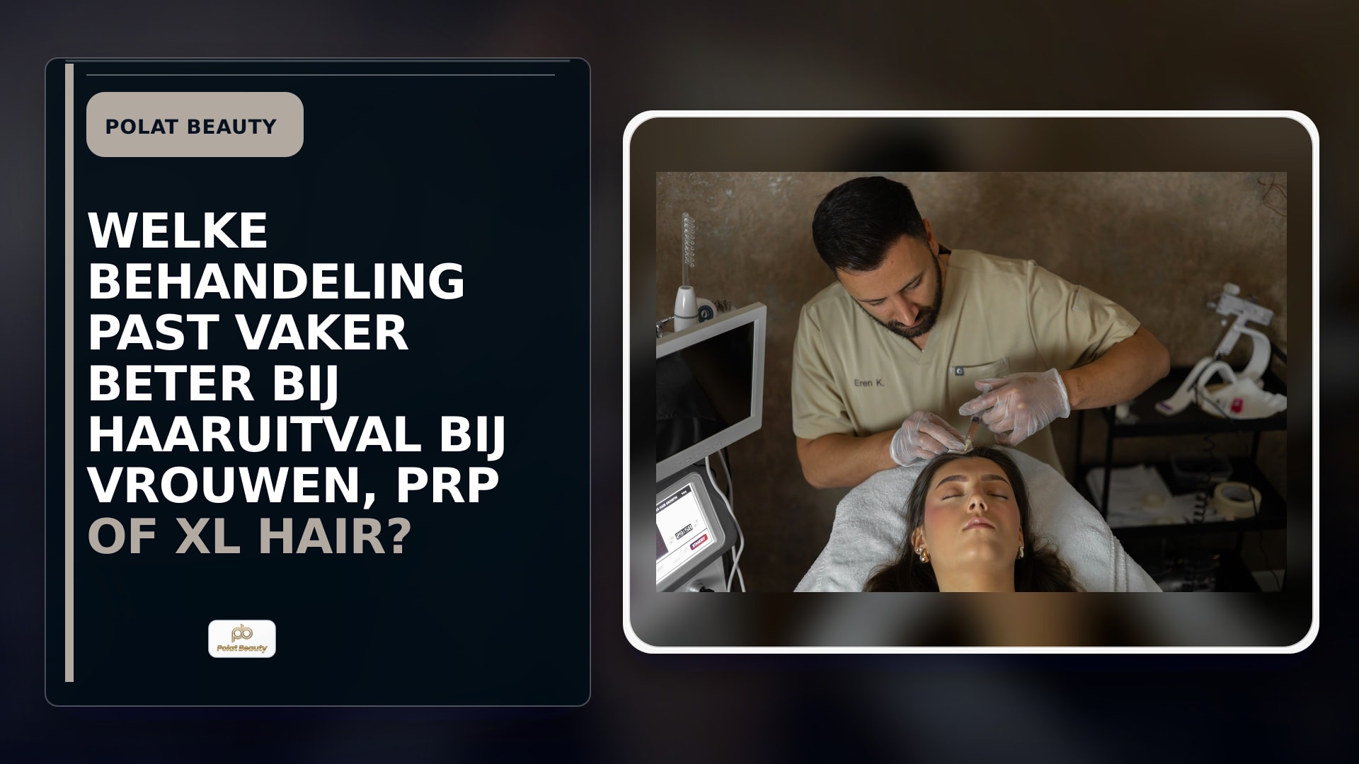 Welke behandeling past vaker beter bij haaruitval bij vrouwen, PRP of XL Hair?